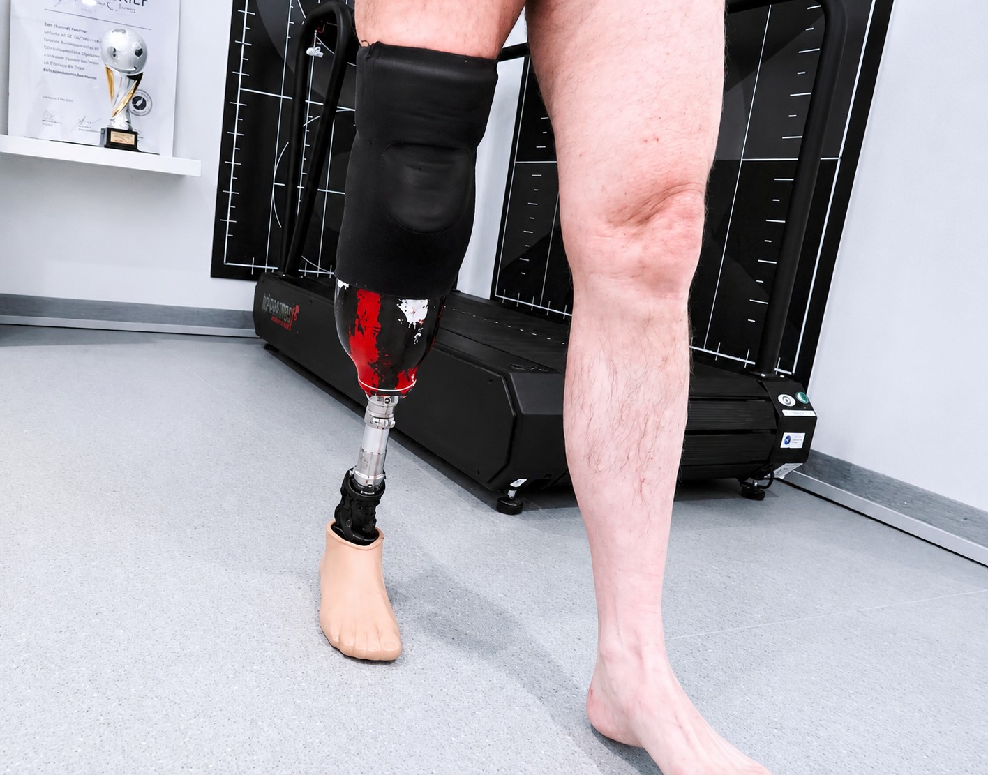 Patient übt mit Unterschenkelprothese das Gehen auf dem Laufband in der Gangschule bei Kächele in Stuttgart